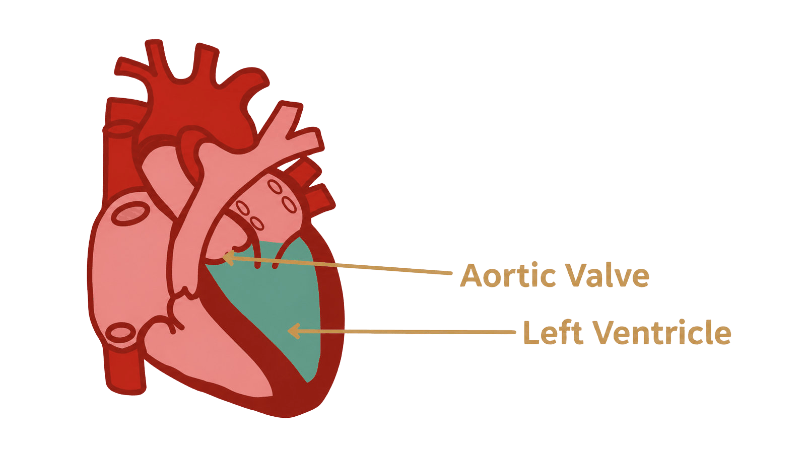 hcm aortic valve left ventricle hcm aortic valve left ventricle